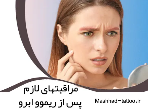 مراقبتهای لازم پس از ریموو ابرو