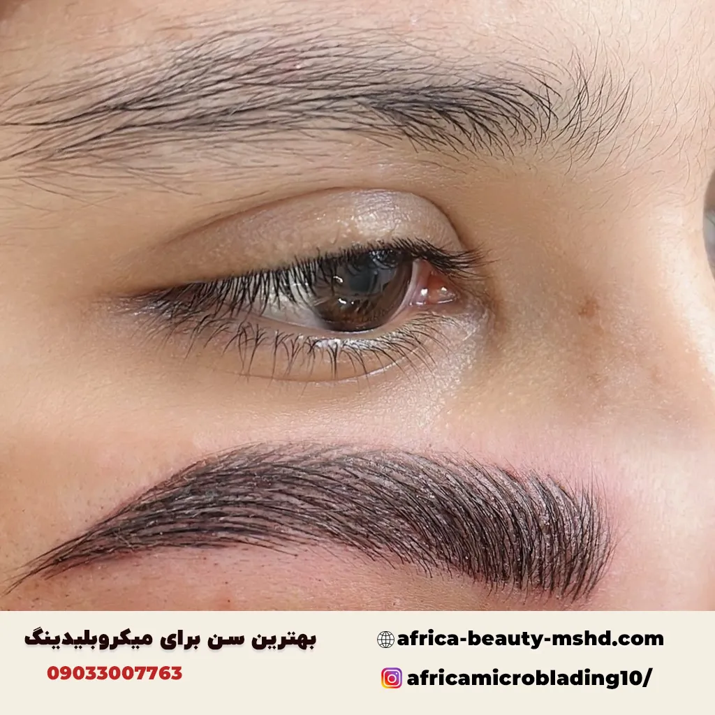 بهترین سن برای انجام میکروبلیدینگ ابرو